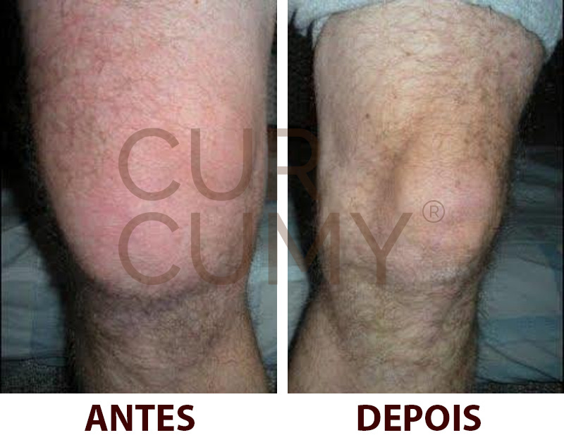 Depoimento Cícero