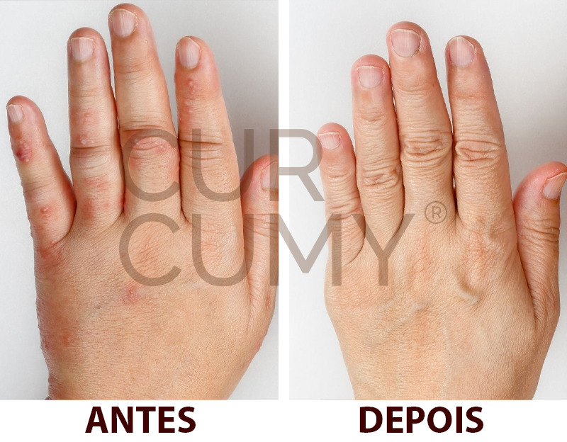 Depoimento Janet