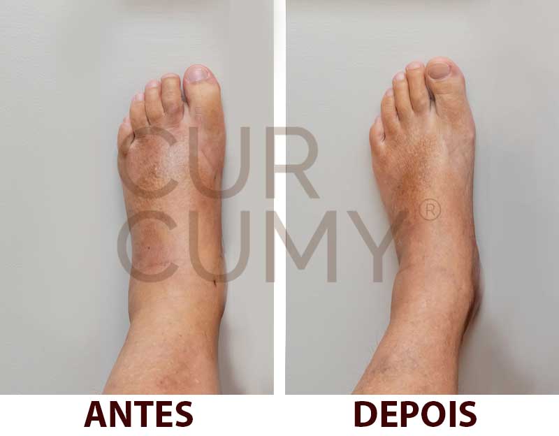 Depoimento Tereza